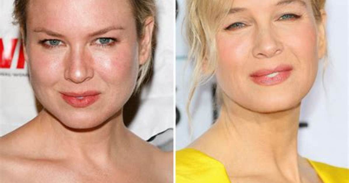 A Dive into Renee Zellweger’s Plastic Surgery Rumors and Her Response to Them over the Year's