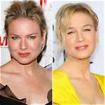 A Dive into Renee Zellweger’s Plastic Surgery Rumors and Her Response to Them over the Year's