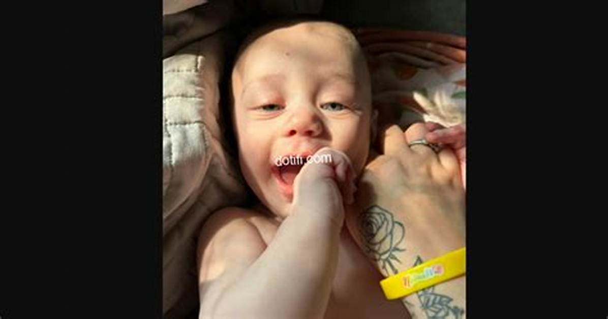 Baby Died in Icu at Memorial Health