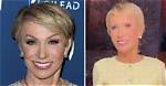 Barbara Corcoran | No Makeup | Plastic Surgery