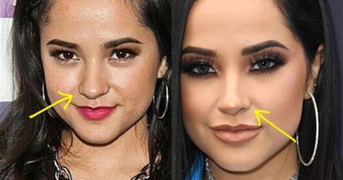 Becky G Nose Job: Before and After Photos 2023