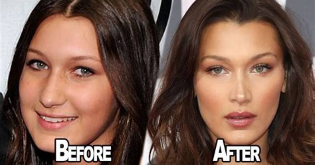 Bella Hadid’s Plastic Surgery, Instagram, Age, Biography, Wikipedia, Height & More