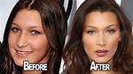 Bella Hadid’s Plastic Surgery, Instagram, Age, Biography, Wikipedia, Height & More