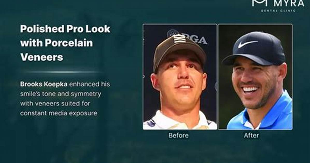 Brooks Koepka | Teeth Before and After