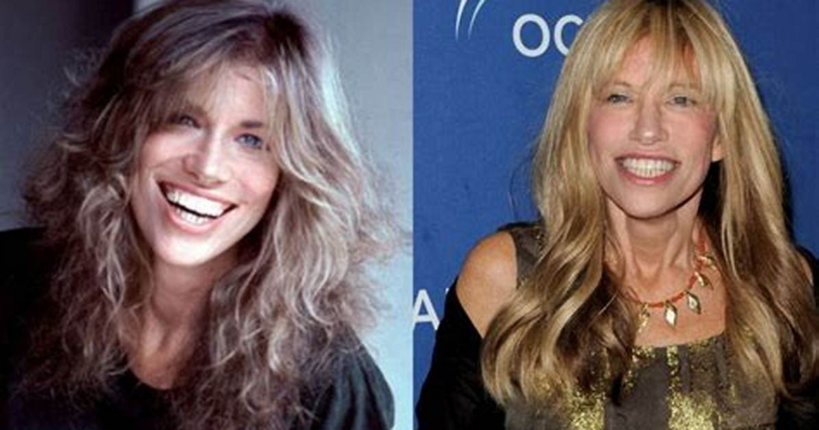 Carly Simon | Wrong with Face? Plastic Surgery Before and After