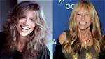 Carly Simon | Wrong with Face? Plastic Surgery Before and After