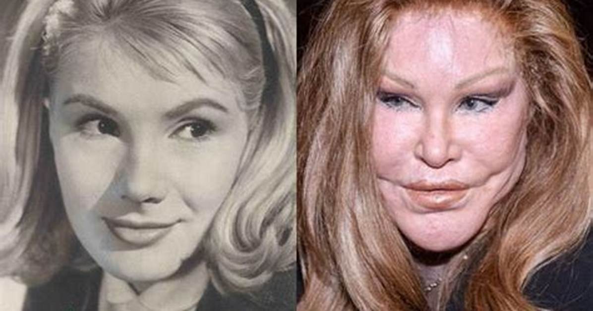 Cat Woman Plastic Surgery Before and After | Why Jocelyn Wildenstein Face Looks So Different