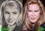 Cat Woman Plastic Surgery Before and After | Why Jocelyn Wildenstein Face Looks So Different