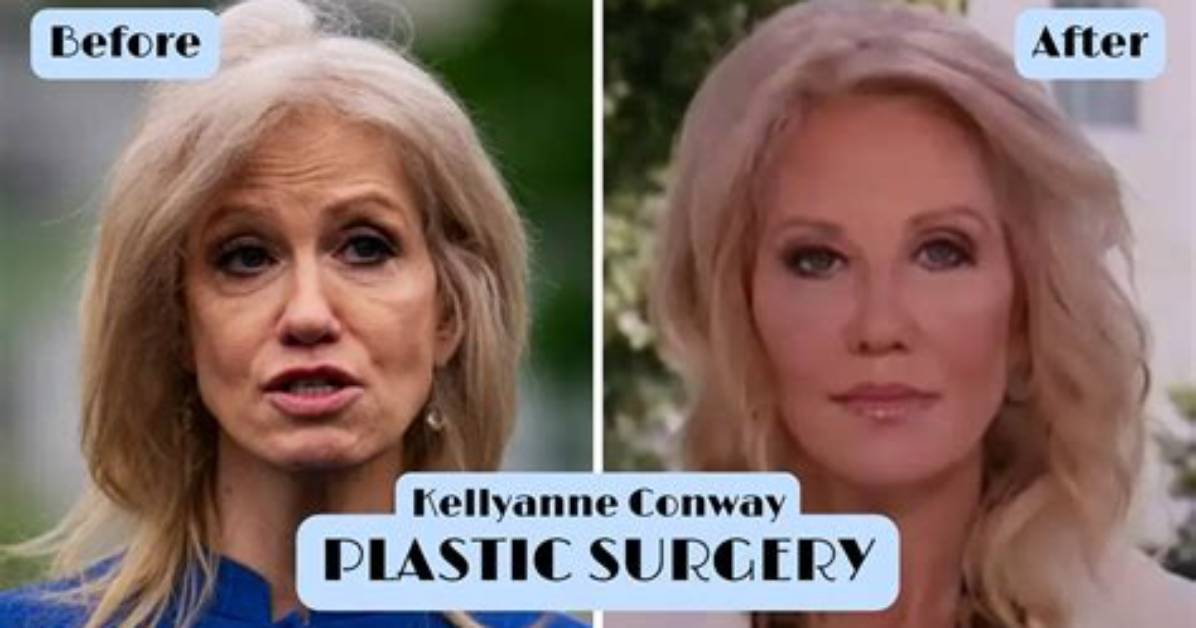 Claudia Conway Plastic Surgery Before and After