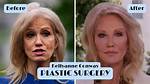 Claudia Conway Plastic Surgery Before and After