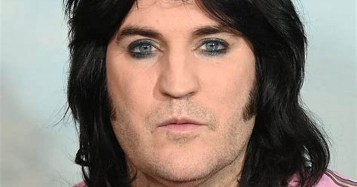 Controversy over Noel Fielding | What He Said | Accusations and Homophobic Jokes