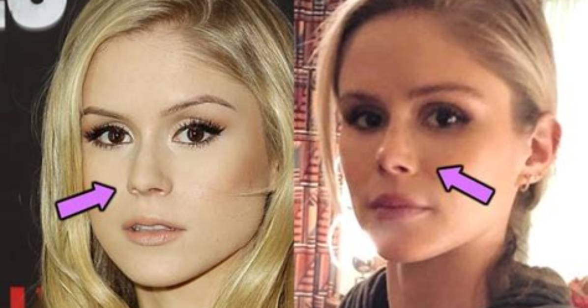 Did Erin Moriarty Get a Nose and Lips Done? Plastic Surgery