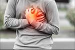 Did He Have a Heart Attack?
