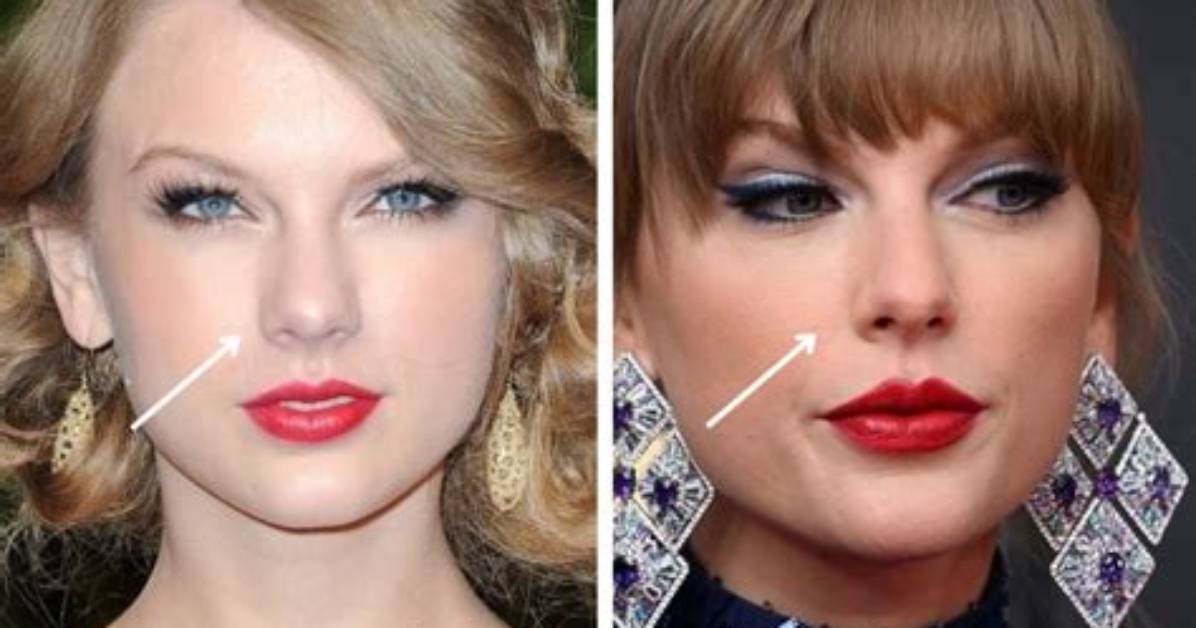 Did She Get Nose Job?
