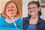 Did Tammy Slaton Undergo Weight-Loss Surgery? Details on Journey