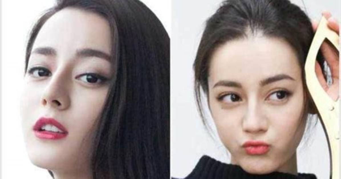 Dilraba Dilmurat Plastic Surgery | Before and After Photos
