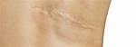 Does She Have a Scar? Surgery and Health Update