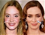 Emily Blunt Botox and Nose Job | Did She Underwent Surgery