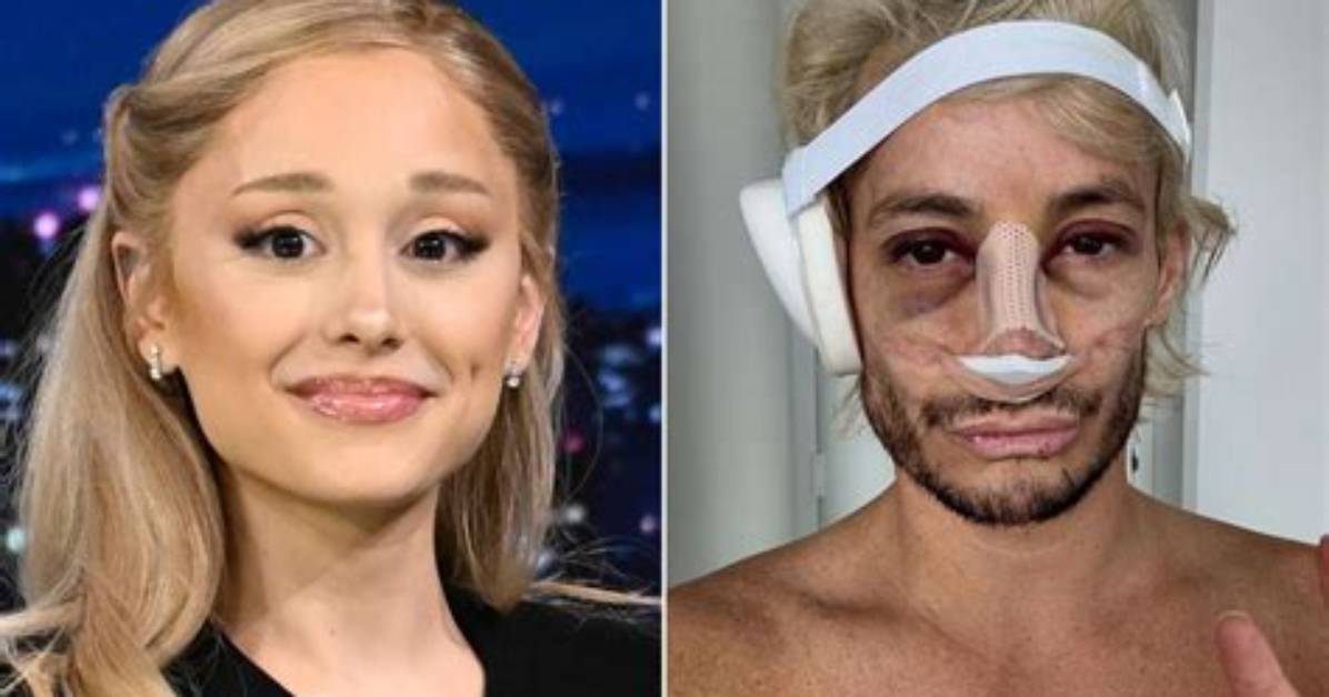 Frankie Grande Plastic Surgery Before and After Look