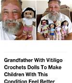 Grandfather with Vitiligo Crochets Dolls for Kids Living with the Same Condition: “They Feel Represented”