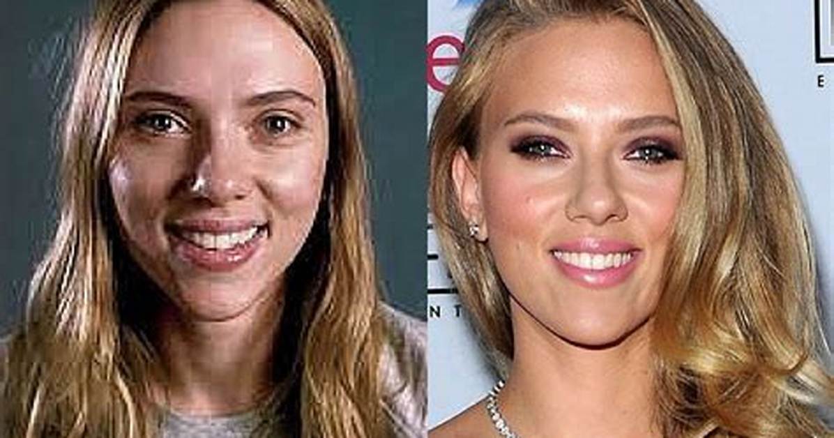 Has Scarlett Johansson Ever Undergone Plastic Surgery? Here's What We Know