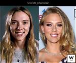 Has Scarlett Johansson Ever Undergone Plastic Surgery? Here's What We Know