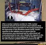 Hisashi Ouchi Corpse Photos, Man Suffered Nuclear and Radiation Accident