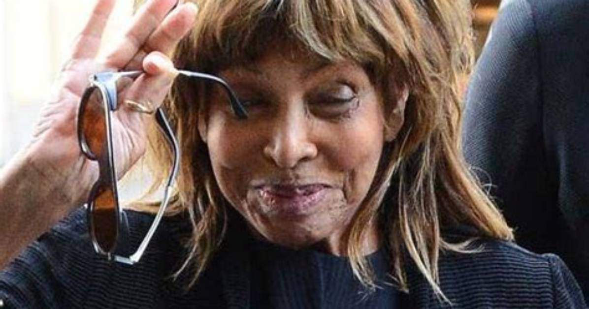 How Did Tina Turner Look Without Wig? Hair Loss and Cancer Update