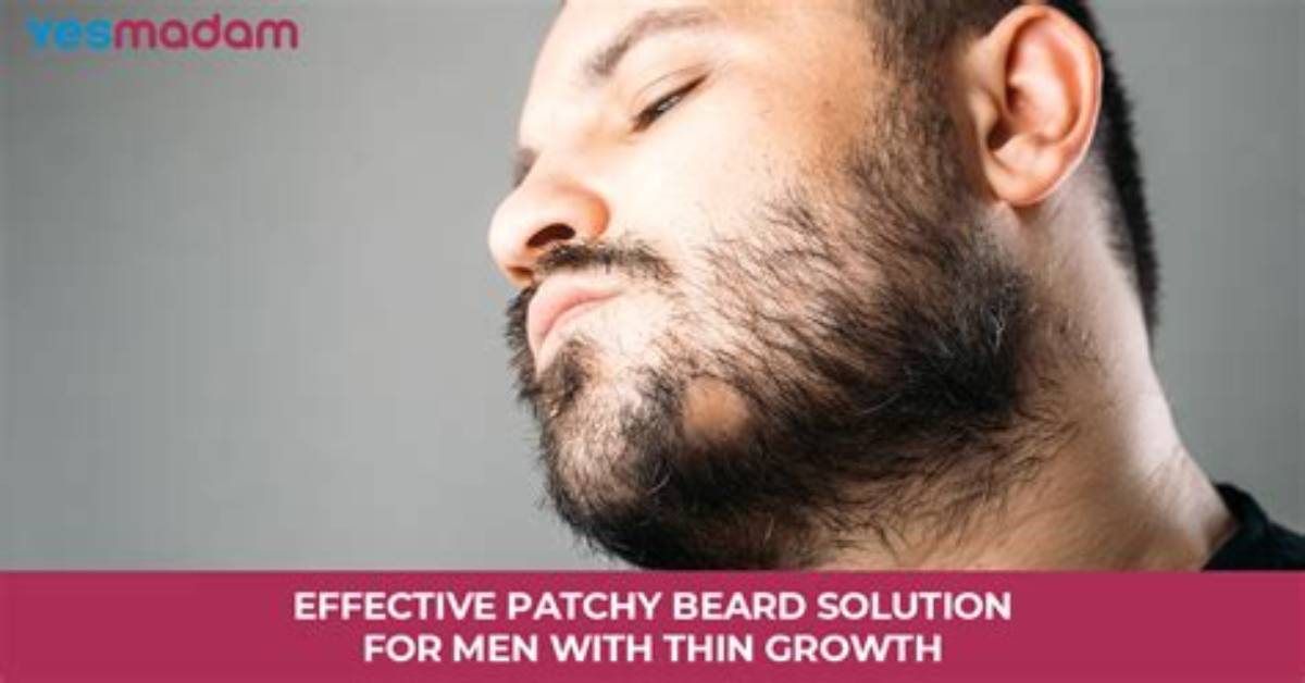 How to Fix a Patchy Beard: 5 Ways to Get Facial Hair You Want