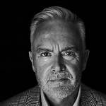 Huw Edwards Teeth Before and After Photo: Reddit and Twitter