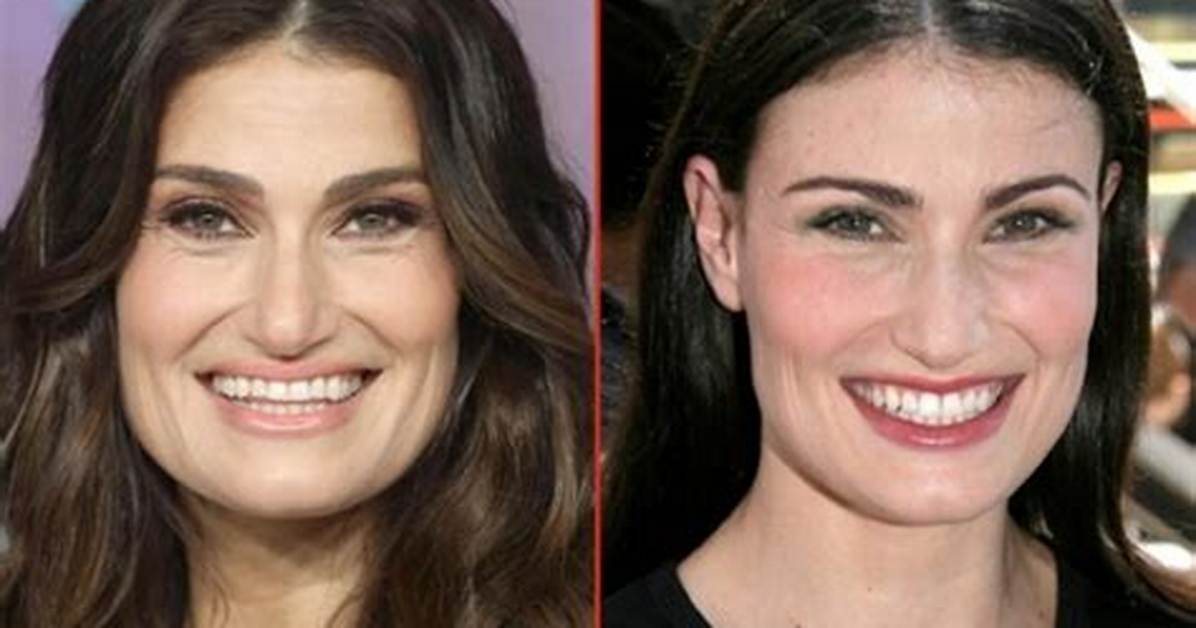 Idina Menzel Nose Job | Before and After Photos