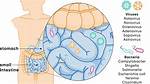Illness at Death Gastrointestinal Infection