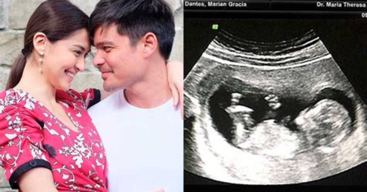 Is Marian Rivera Pregnant Again? Husband and Health Update
