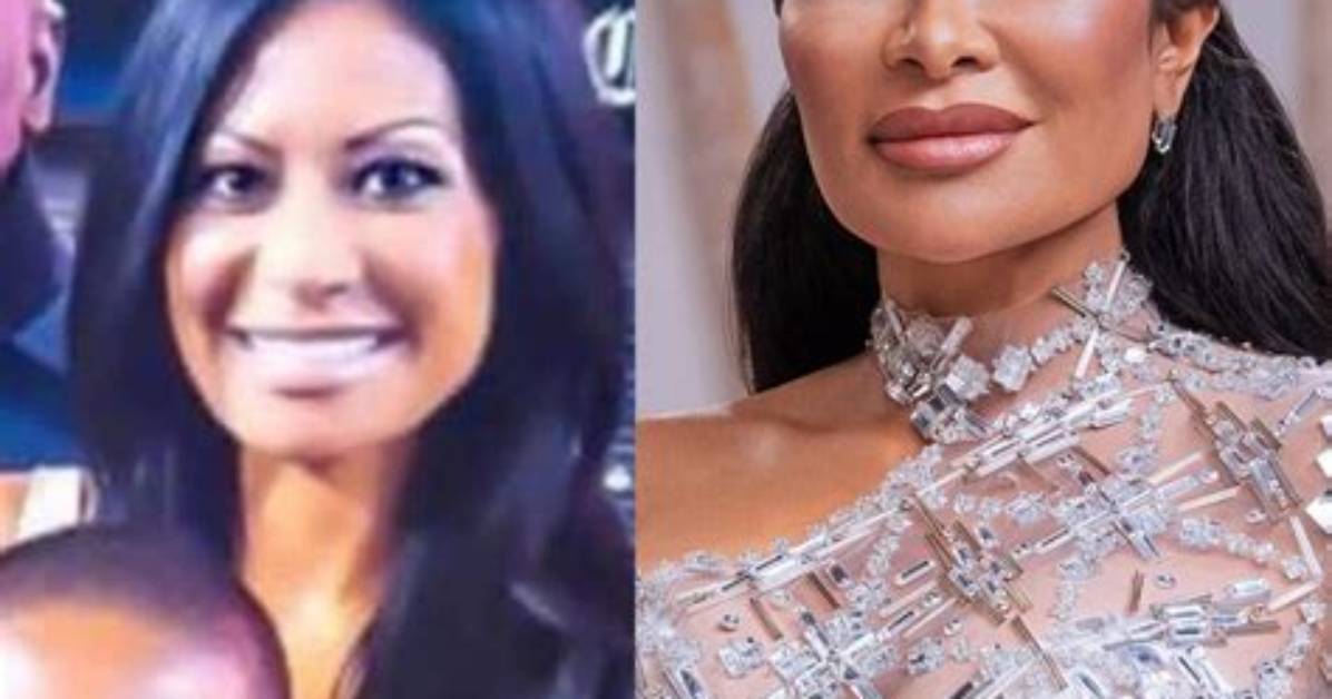 Jen Shah's Plastic Surgery Rumors on 'Rhoslc' May Have Truth to Them