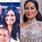 Jen Shah's Plastic Surgery Rumors on 'Rhoslc' May Have Truth to Them
