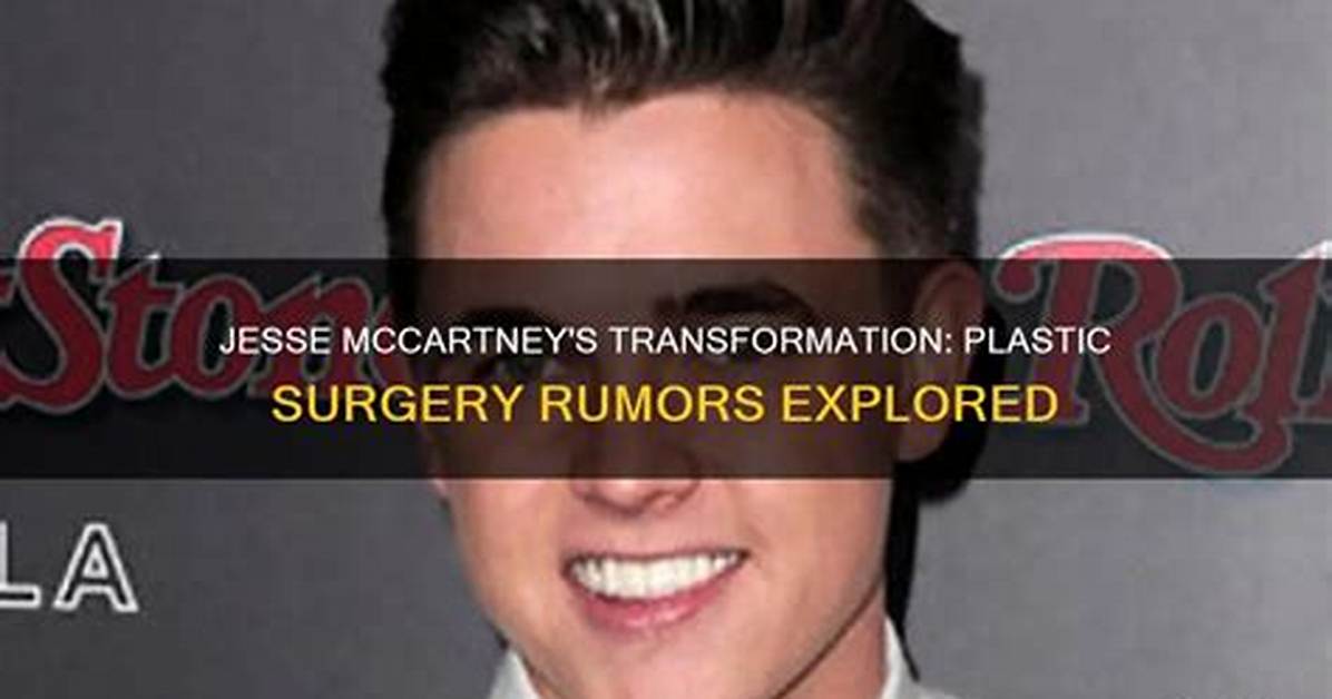 Jesse Mccartney Plastic Surgery Rumors Arise Even in Grief