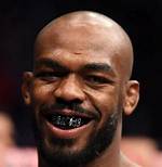 Jon Jones Teeth Before and After | What Does He Have on His Teeth