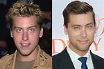 Lance Bass Plastic Surgery: Before and After Photos