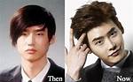 Lee Jong Suk | Before Plastic Surgery? Wrong with His Face?