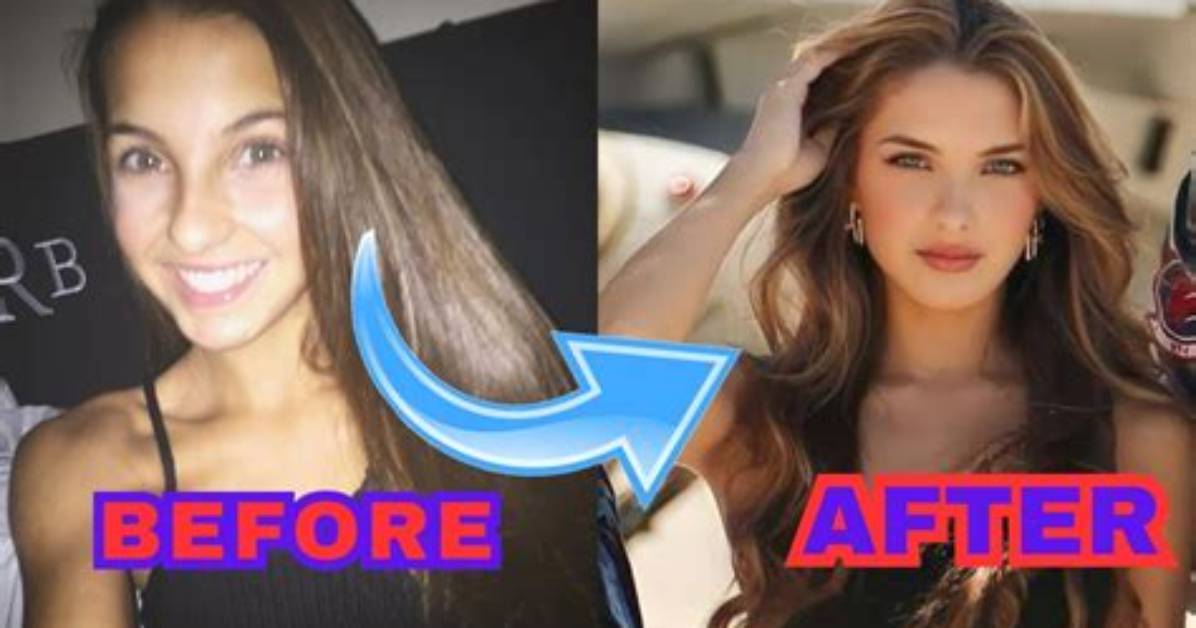 Lexi Rivera Plastic Surgery | No Makeup Before and After Looks
