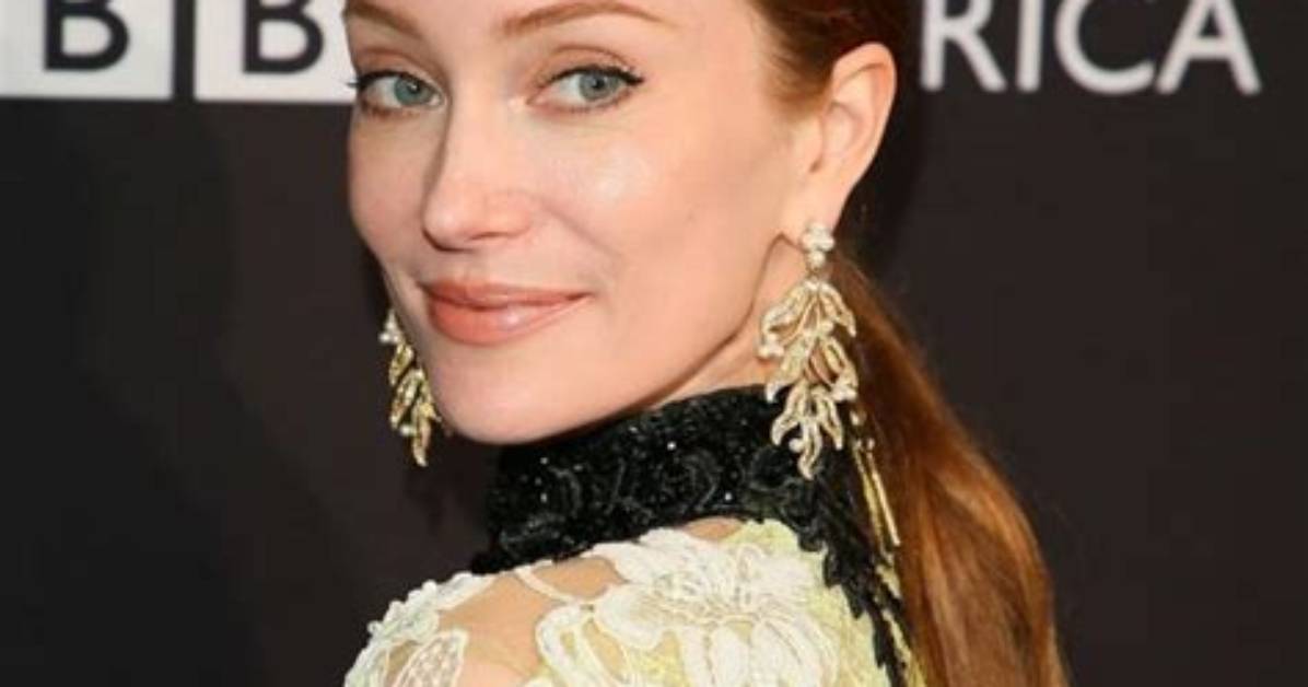 Lotte Verbeek Movies, Bio, Wiki, Age, Dating, Forehead, and Net Worth