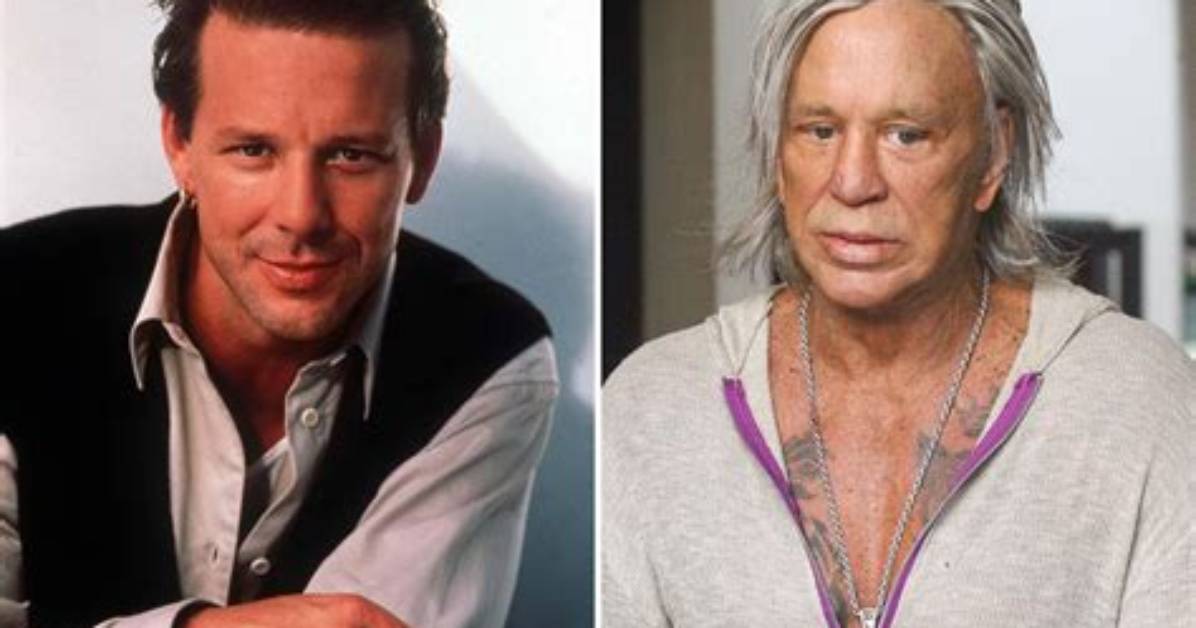Mickey Rourke’s History with Plastic Surgery Explained — What Happened to Him?