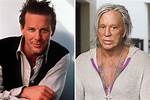 Mickey Rourke’s History with Plastic Surgery Explained — What Happened to Him?