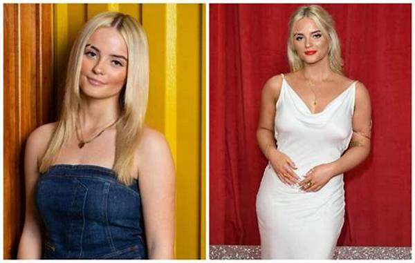 Millie Gibson's Biography: Age, Height, Parents, Scar, Career