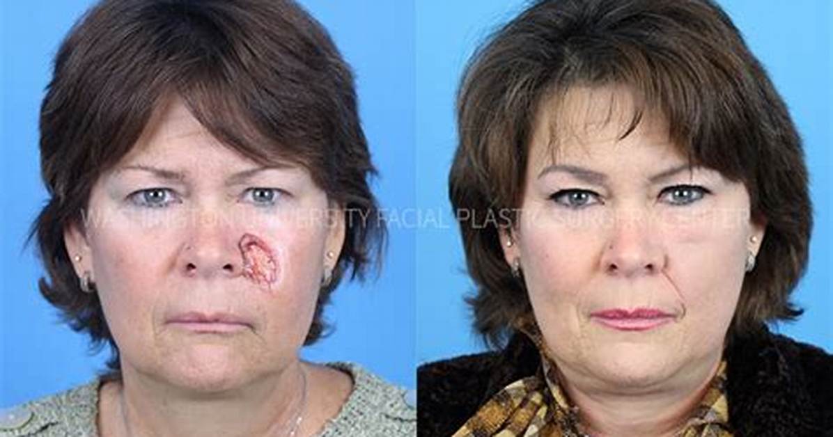 Plastic Surgery Before & After