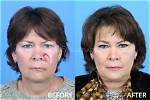 Plastic Surgery Before & After