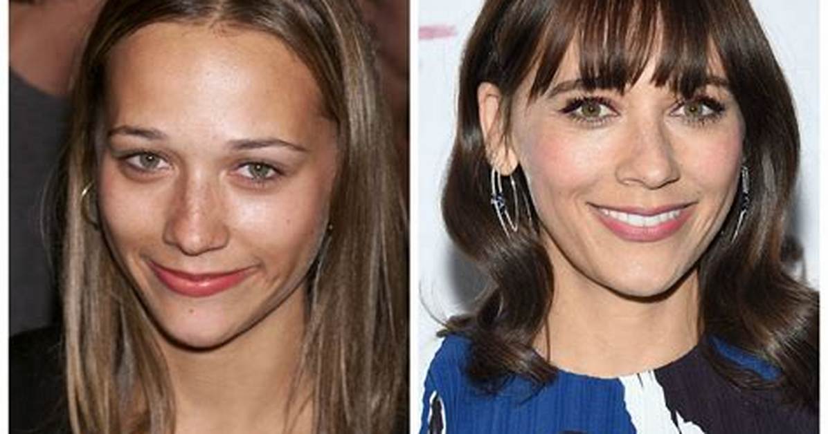 Rashida Jones Plastic Surgery: Before and After Photos