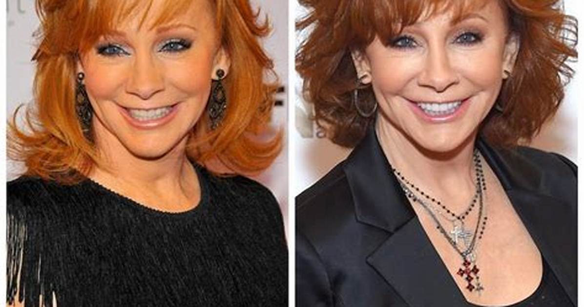 Reba Mcentire Plastic Surgery? See Her Transformation
