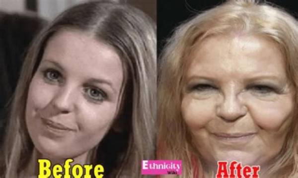 Sally Thomsett Face Surgery: Before and After Pictures