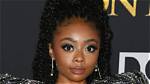 Skai Jackson Net Worth – How Much Is Skai Worth?
